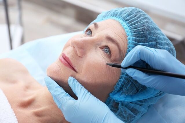 Preparación para un procedemento de lifting facial non cirúrxico