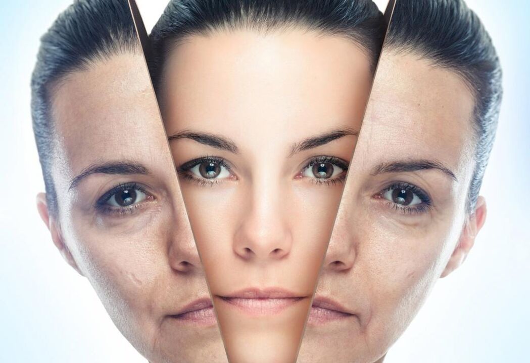 métodos de rexuvenecemento facial