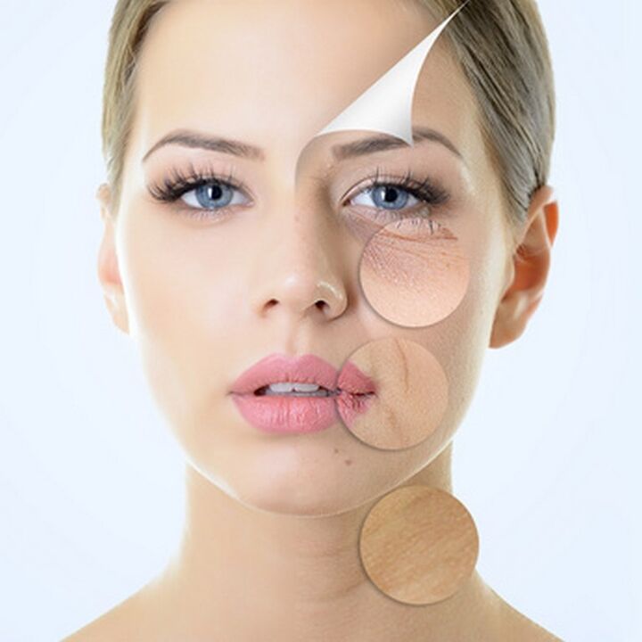 Imperfeccións da pel facial - indicacións para procedementos anti-envellecemento